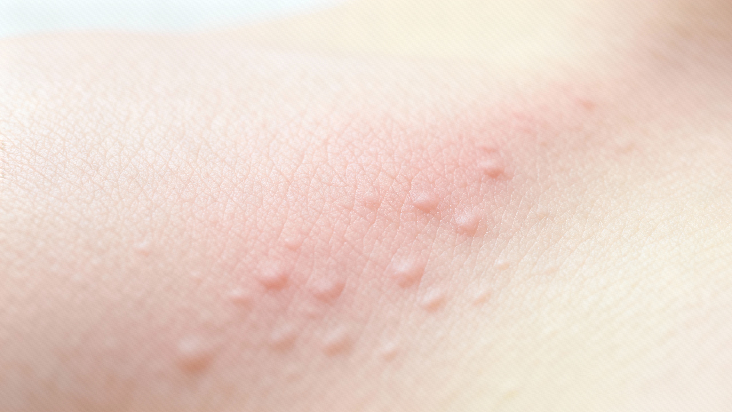 Separating hives facts from fiction